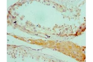 Immunohistochemistry of paraffin-embedded human testis tissue using ABIN7168578 at dilution of 1:100 (SALL4 anticorps  (AA 1-220))