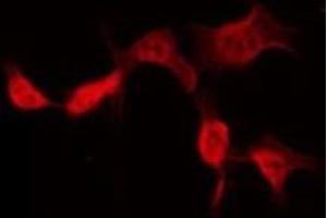 ABIN6275402 staining Hela by IF/ICC. (POTEB anticorps)