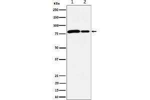 anti-MMUT antibody