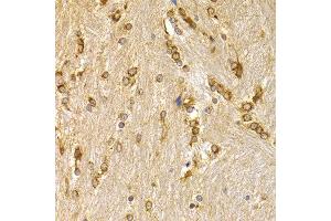 Immunohistochemistry of paraffin-embedded mouse brain using APLP1 antibody at dilution of 1:200 (400x lens). (APLP1 anticorps)