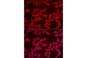 Immunofluorescence analysis of HeLa cell using BAP1 antibody. (BAP1 anticorps)
