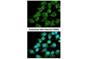 ICC/IF Image Immunofluorescence analysis of methanol-fixed A431, using NDUFS1, antibody at 1:200 dilution.