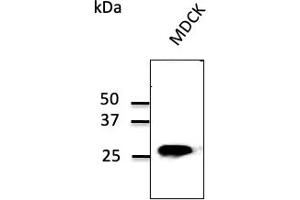 Western Blotting (WB) image for anti-RAB5B, Member RAS Oncogene Family (RAB5B) (C-Term) antibody (ABIN1439995)