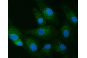 IF analysis of TOLLIP using anti-TOLLIP antibody (ABIN7599202). (TOLLIP anticorps  (AA 1-274))