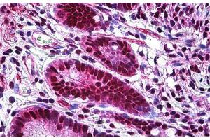 Human Small Intestine: Formalin-Fixed, Paraffin-Embedded (FFPE)