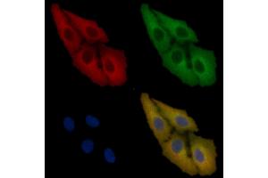 SOD1 Mouse Monoclonal Antibody staining Hela cells by IF/ICC. (SOD1 anticorps  (Internal Region))