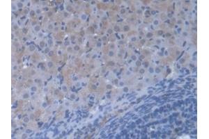 Detection of VARS in Mouse Ovary Tissue using Polyclonal Antibody to Valyl tRNA Synthetase (VARS)