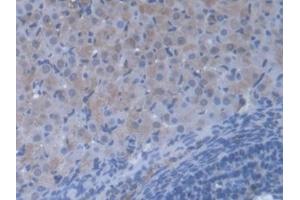 Detection of VARS in Mouse Ovary Tissue using Polyclonal Antibody to Valyl tRNA Synthetase (VARS) (VARS anticorps  (AA 186-421))