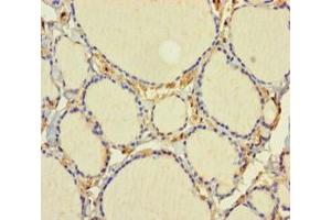 Immunohistochemistry of paraffin-embedded human thyroid tissue using ABIN7161811 at dilution of 1:100