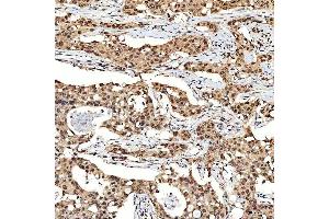 IHC analysis of SNF2H/SMARCA5 using anti-SNF2H/SMARCA5 antibody (ABIN7602001).