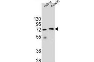 Western Blotting (WB) image for anti-Potassium Channel Tetramerisation Domain Containing 8 (KCTD8) antibody (ABIN2996279) (KCTD8 anticorps)