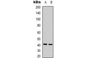 Western blot analysis of Ghrelin Receptor expression in Jurkat (A), rat liver (B) whole cell lysates. (GHSR anticorps)