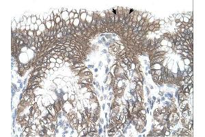 TARS antibody was used for immunohistochemistry at a concentration of 4-8 ug/ml.