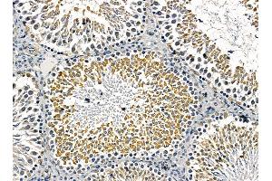 ABIN7095431 and ABIN7099488 at 1/100 staining rat testis tissue by IHC-P. (OSBPL5 anticorps)