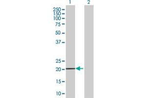 Western Blot analysis of MS4A4A expression in transfected 293T cell line by MS4A4A MaxPab polyclonal antibody.