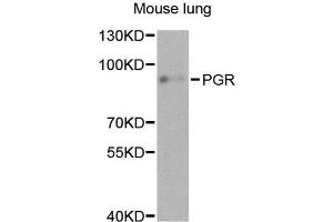 Western blot analysis of extracts of mouse lung, using PGR antibody. (Progesterone Receptor anticorps)