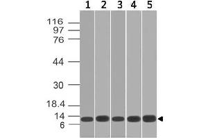 Image no. 1 for anti-S100 Calcium Binding Protein A8 (S100A8) antibody (ABIN5026984) (S100A8 anticorps)