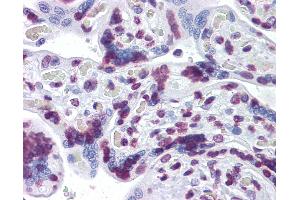Anti-RBM5 antibody IHC of human placenta. (RBM5 anticorps  (AA 75-184))