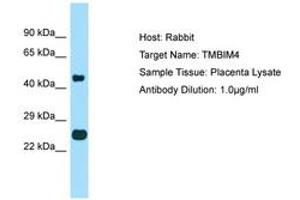 Image no. 1 for anti-Transmembrane BAX Inhibitor Motif Containing 4 (TMBIM4) (AA 110-159) antibody (ABIN6750079) (TMBIM4 anticorps  (AA 110-159))