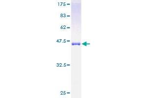 Image no. 1 for Sorcin (SRI) (AA 1-198) protein (GST tag) (ABIN1321326)