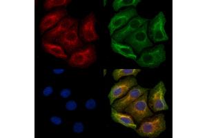 ABIN6263822 and ABIN6272378 staining Hela cells by IF/ICC. (OMG anticorps  (Internal Region))