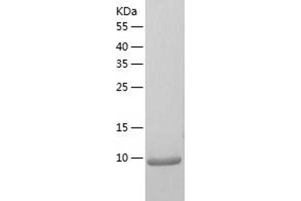 SVIP Protein (AA 1-77) (His tag)