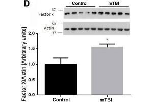 At two weeks upon injury, brain thrombin activity and concentration are similar between mTBI exposed animals and controls. (Factor 10 Heavy Chain (AA 351-448) anticorps)