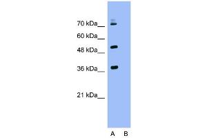 Host:  Rabbit  Target Name:  KEAP1  Sample Type:  HepG2  Lane A:  Primary Antibody  Lane B:  Primary Antibody + Blocking Peptide  Primary Antibody Concentration:  1.