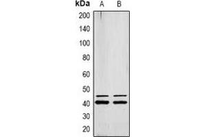 Western blot analysis of ERK1/2 (pY222/205) expression in MCF7 (A), Jurkat (B) whole cell lysates. (ERK1/2 anticorps  (pTyr205, pTyr222))