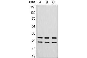 Western blot analysis of Cathepsin G expression in A549 (A), MCF7 (B), rat heart (C) whole cell lysates. (Cathepsin G anticorps  (N-Term))
