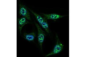 Immunocytochemistry (ICC) image for anti-Inner Centromere Protein Antigens 135/155kDa (INCENP) (AA 369-583) antibody (ABIN1844019)