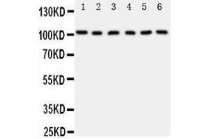 Western Blotting (WB) image for anti-Minichromosome Maintenance Complex Component 2 (MCM2) (AA 884-904), (C-Term) antibody (ABIN3044274) (MCM2 anticorps  (C-Term))