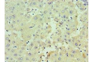 Immunohistochemistry of paraffin-embedded human liver tissue using ABIN7162980 at dilution of 1:100 (HSD17B4 anticorps  (AA 437-736))