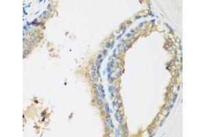 Immunohistochemistry of paraffin-embedded Human prostate using WDR77 Polyclonal Antibody at dilution of 1:200 (40x lens). (WDR77 anticorps)