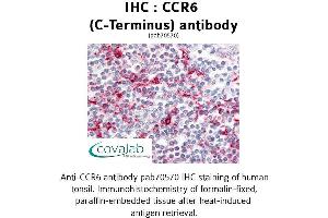 Image no. 1 for anti-Chemokine (C-C Motif) Receptor 6 (CCR6) (C-Term) antibody (ABIN1732778) (CCR6 anticorps  (C-Term))