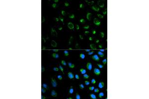 Immunofluorescence analysis of MCF7 cell using FXN antibody.