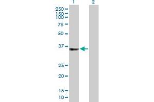 Western Blot analysis of C2orf43 expression in transfected 293T cell line by C2orf43 MaxPab polyclonal antibody. (LDAH/C2orf43 anticorps  (AA 1-325))