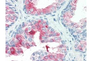 Human Prostate (formalin-fixed, paraffin-embedded) stained with ANXA1at 20 µg/ml followed by biotinylated goat anti-rabbit IgG secondary antibody, alkaline phosphatase-streptavidin and chromogen. (Annexin a1 anticorps  (N-Term))