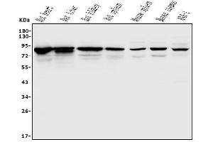 Western blot analysis of Afm using anti-Afm antibody (ABIN7601653).