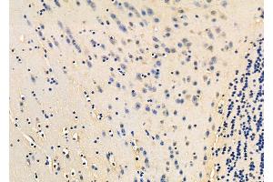 ABIN6261445 and ABIN6278454 at 1/100 staining Mouse brain tissue by IHC-P. (EEF1B2 anticorps  (Internal Region))