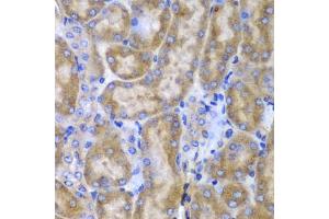Immunohistochemistry of paraffin-embedded mouse kidney using SPARC antibody (ABIN3022250, ABIN3022251, ABIN1513555 and ABIN6218694) at dilution of 1:100 (40x lens). (SPARC anticorps  (AA 18-303))