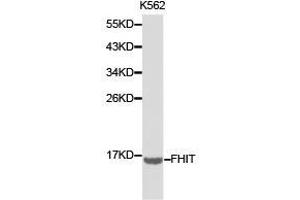 Western Blotting (WB) image for anti-Fragile Histidine Triad (FHIT) antibody (ABIN1872693) (FHIT anticorps)