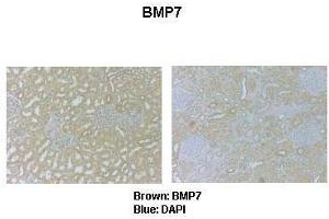 Sample Type :  Human kidney (Proteinase K)   Primary Antibody Dilution :   1:1000  Secondary Antibody :  Anti-rabbit-HRP   Secondary Antibody Dilution :   1:5000  Color/Signal Descriptions :  Brown: BMP7 Blue: DAPI   Gene Name :  Bmp7  Submitted by :  Christina Theodorpoulos, Queensland Univ.
