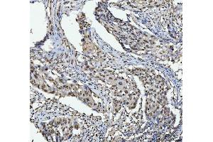 IHC analysis of hnRNP L/HNRNPL using anti-hnRNP L/HNRNPL antibody (ABIN7600130). (HNRNPL anticorps  (AA 152-569))