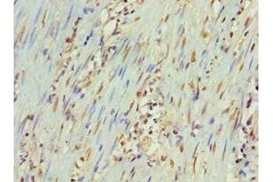 Immunohistochemistry of paraffin-embedded human epityphlon tissue using ABIN7165931 at dilution of 1:100