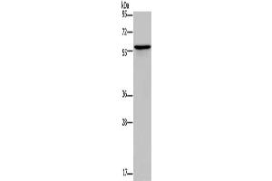 Gel: 10 % SDS-PAGE, Lysate: 40 μg, Lane: Human lung cancer tissue, Primary antibody: ABIN7189699(ADRA1B Antibody) at dilution 1/550, Secondary antibody: Goat anti rabbit IgG at 1/8000 dilution, Exposure time: 1 minute (ADRA1B anticorps)