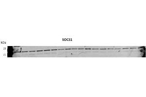 SOCS1 antibody - N-terminal region  validated by WB using Huh7 Cells transfected with microRNA at 1:1000. (SOCS1 anticorps  (N-Term))