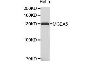 Western blot analysis of extracts of HeLa cells, using MGEA5 antibody. (MGEA5 anticorps)