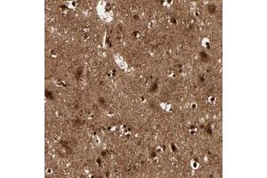Immunohistochemical staining (Formalin-fixed paraffin-embedded sections) of human cerebral cortex with MT3 polyclonal antibody  shows strong nuclear and cytoplasmic positivity in neuronal cells and glial cells. (MT3 anticorps)