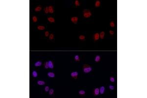 Immunofluorescence analysis of A-549 cells using YE Rabbit pAb (ABIN6130808, ABIN6150331, ABIN6150332 and ABIN6221925) at dilution of 1:50 (40x lens). (GAS41 anticorps  (AA 1-227))